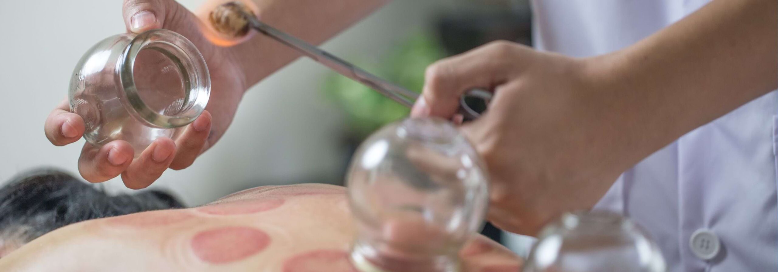 CUPPING IN BANGALORE
